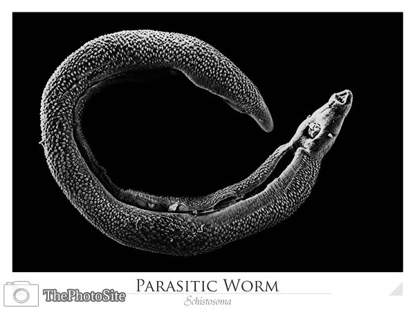 Parasitic Adult Worm (Schistosoma) - Click Image to Close
