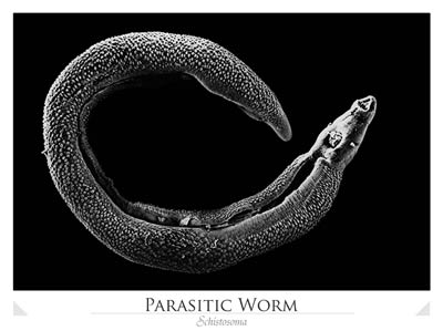 Parasitic Adult Worm (Schistosoma)